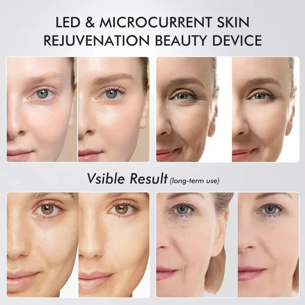 Before and after collage of eye area brightness and firmness using the Booster Pro LED wand—results vary.